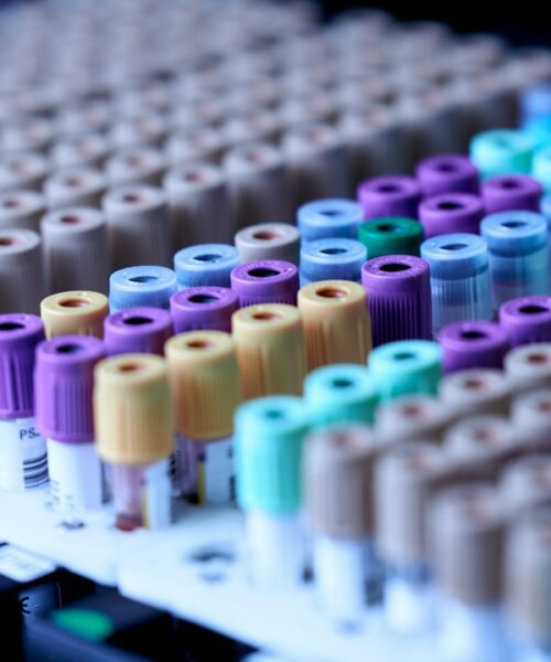 PCR Testleri